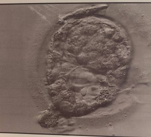 An ultrasound image of an FET Embryo provided during my fertility journey