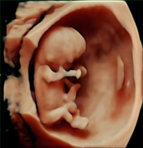 Ultrasound image of San Diego Maternity Photographer's baby